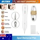 Machine Skin Beauty Device Handheld Picosecond Laser Pen Tattoo Freckle Removal