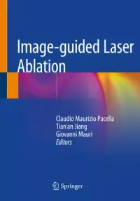 在飛比找博客來優惠-Image-Guided Laser Ablation