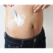 Shower Shield Transparent Film Wound Dressing Waterproof Disposable Moisture Barrier Barrier Wound Cover (50 Pieces/set) LVQ