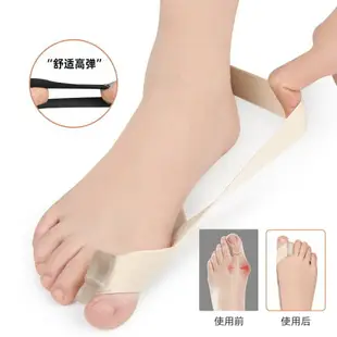 大拇指外翻拉力帶腳趾矯正器矯正器男女用可穿鞋大腳骨重疊分趾器