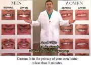 TOP MEDIUM VENEERS INSTANT SMILE BEAUTIFUL TEETH W FREE HARD CASE / MAKEOVER