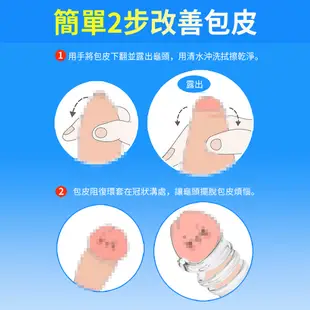 取悅｜雙重阻力包皮阻復環4件套組 情趣用品 包皮矯正 老二環 男用情趣 隱形金剛 包皮太長 包莖矯正