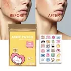 96pcs Acne Patches Cat Shaped Acne Treatment Sticker Invisible Acne Cover $d