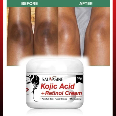 ✅ Dark Skin , Spot Bleaching Cream Whitening Lightening Retinol Care Face & Body
