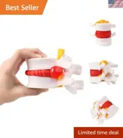Comprehensive Lumbar Disc Herniation Model with Flexible Discs for Learning