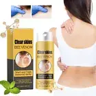 Fast Skin Tag Wart Remover Treatment Safe Wart Acne Removal Body Face Liquid AU