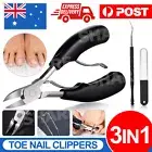 Toenail Thick Toe Nail Clipper Cutter Fungus Ingrown Scissors Chiropody Podiatry