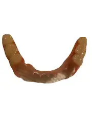BURBANK Replacement DentalLab Partials Lower Side 6 teeth CustomMadeMissingTooth