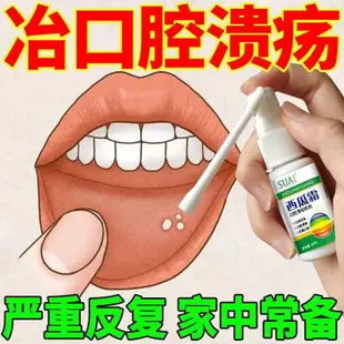 西瓜霜~口腔潰瘍噴劑~正品嘴巴上火舌頭起泡牙周咽喉紅腫牙疼牙齦腫