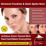 #1 TOP FRECKLE REMOVER CREAM FACE ANTI AGING WRINKLE