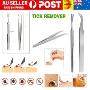 Stainless Steel Pet Tick Remover Tool Fleas Lice Tweezers Clip Set for Cat Dog