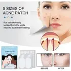 Tag Remover Patch Hydrocolloid Master Ance Pimple Patches Acne Spot Treatment