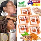 5/3/2Pack Tumeric Soap Acne Dark Spots Remove Skin Whitening Body Bleaching Soap