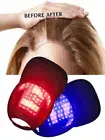 48 LEDs Red Blue Light Therapy Cap Hair Regrowth Hat Anti-Hair Loss Hair Growth