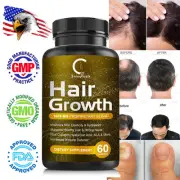 Advanced Anti Hair Loss Capsules DHT Blocker Fast Hair Growth Vitamins Pills