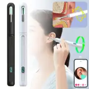 Wireless Ear Wax Remover Camera HD Ear Endoscope Spoon Pick Cleaning Tool Kit QG