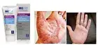 Medicated Moisturizing Psoriasis Cream With 3% Salicylic Acid, Multi-symptoms