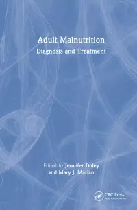 在飛比找博客來優惠-Adult Malnutrition: Diagnosis 