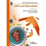 AIDS AND TUBERCULOSIS: A DEADLY LIAISON