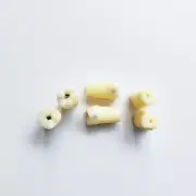Dental Model Dentist Tooth Student School Molar Vitro Teeth Decay Caries Screw