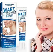 Wart Removal Cream 20g, Effective Treatment of Warts, Corns Spot Moles, Moles and Calluses, Wart Remover Cream for Body and Hands