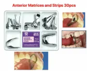10 Boxes 30 Pcs/box Dental Proximal Anterior Strips Twin Matrices Anterior
