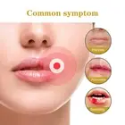 60 Cold Sore Patches Acne Spot Pimple Skin Breathable Blemish Hydrocolloid Patch