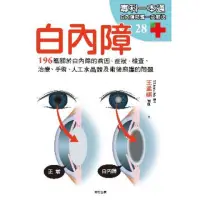 在飛比找momo購物網優惠-【MyBook】白內障：196篇關於白內障的病因、症狀、檢查