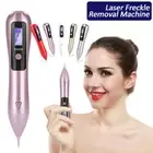 Hot LCD Laser Freckle Removal Pen Skin Mole Dark Spot Wart Tag Remover Machine