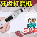 【台灣熱銷】牙齒打磨器【插電款】磨牙機器牙齒磨平拋光電動清潔牙結石牙垢牙漬牙齒打磨