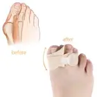 1 Pair/2Pcs Hallux Valgus Separator Orthoses Toes Corrector Adjuster Feet Ca _we