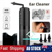 Fully Automatic Electric Ear Cleaner Spray Earwax Smart Ear Flusher with 3 Modes