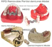 Dental RPD Removable Partial dentures Model Typodont lmplant Model