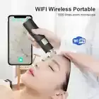 Portable 1000x Digital Wifi Wireless Microscope Skin Scalp Analyzer ConnectPhone