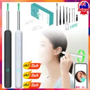 Wireless HD Ear Wax Remover Camera Ear Endoscope Spoon Pick Ear Cleaning Tool