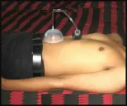 Acupressure Navel / Nabhi Displacement Pump for Surgical Relives Stomach Pain