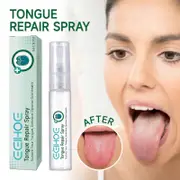 Unbrand Tongue Repair Spray 30ml Reduce Swelling Tongue Relief Treatment Spray for Bad Breath, Tongue Repair Spray for Dryness& Bad Breath 3pcs