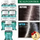 Solid Scalp Hair Control Hair Ampoule 5EA Self Hair Clinic Treatment Home Care