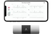 KardiaMobile 6-Lead Personal EKG Monitor Six Views of The Heart Detects AFib and Irregular Arrhythmias Instant Results in 30 Seconds Works with Most Smartphones