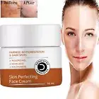 Pigmentation Melasma Dark Spot Uneven Tone Tan Removal Kojic Acid Face Cream