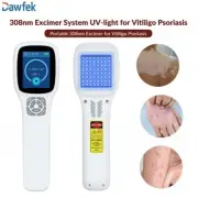 Psoriasis Eczema Vitiligo Various Skin Diseases Therapy for 308nm UVB Light
