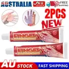 2PCS Numbness Limb Suitable for Finger Hand Foot Numb Cream Muscle Soreness ~~