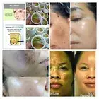 Melasma Cream Remove Dark Sun Spot Acne Pimples Freckles Anti-Aging Scars