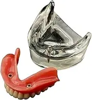 Dental Overdenture Inferior Model Removable Demo Model, 2 Implants Demo, for Teaching, Studying, Patient Communication