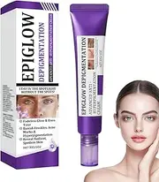 Epiglow Melanex Advanced Anti-Hyperpigmentation Cream, Anti Ageing Face Cream, Dark Spot Remover for Face, Brightening Freckle With Niacinamide, Tone Correcting Moisturizer, Reduces Wrinkles (1)