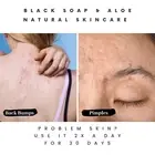 Eczema Relief: Discover Black Soap's Soothing Power
