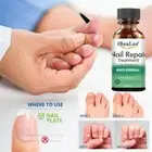 Nail Fungus Removal Cream Anti Fungal Foot Nails Repair Treatment Care Nice