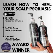 Scalp & Body Care For Your: Psoriasis, Eczema, Itching, Sores, Scabs & Dandruff - 10 Minute Miracle - Essential Bundle, LARGE BOTTLES 500ML