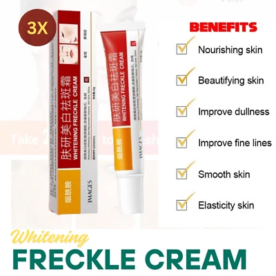 3X Whitening Freckle Cream Remove Dark Spots Face Creams Niacinamide Free Ship