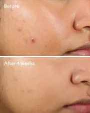 Murad Clarifying Water Gel 60ml